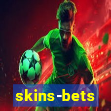 skins-bets