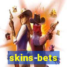 skins-bets